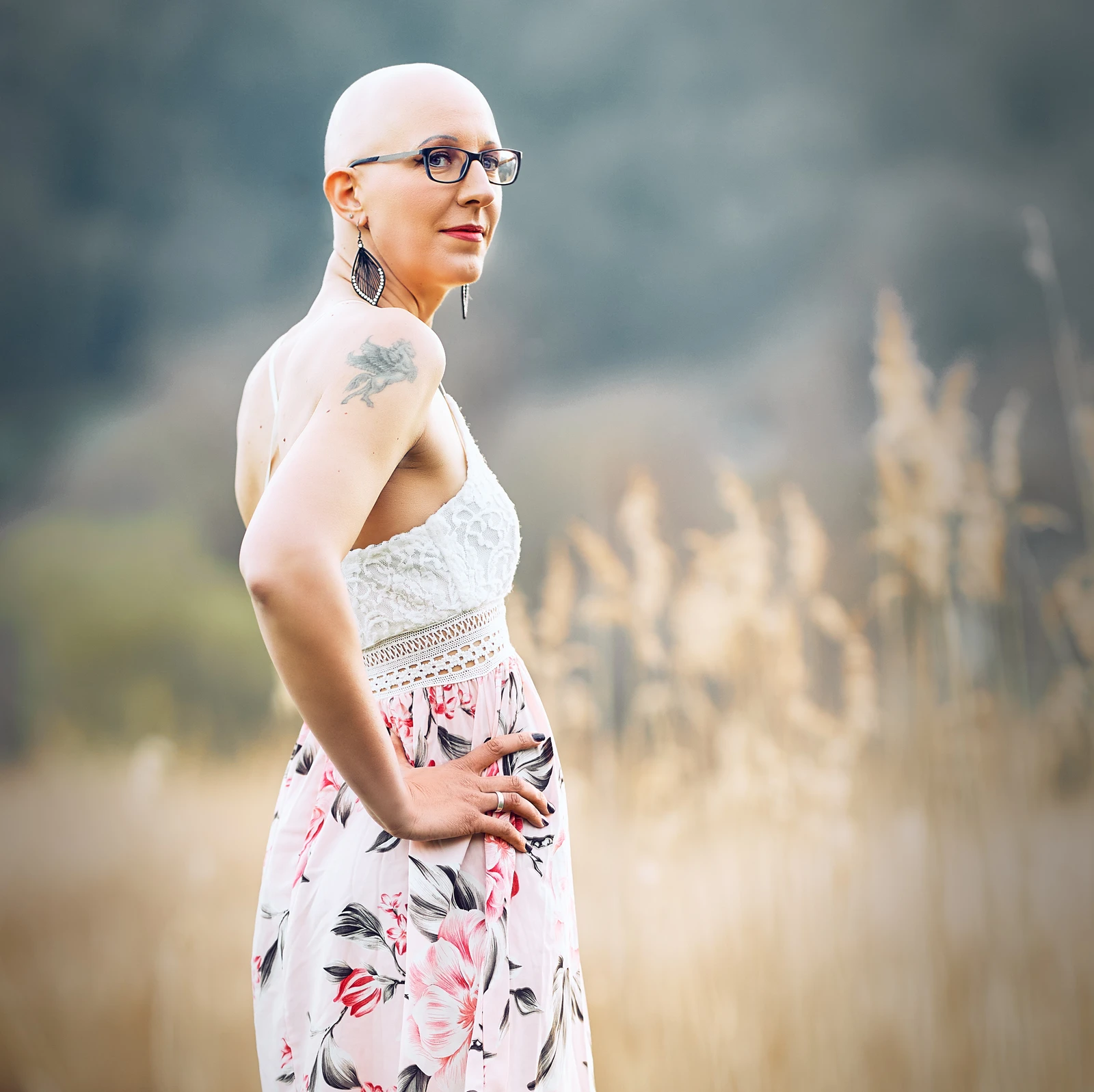 Bild 11 Portraitfotos Fotoshooting alopecia areata